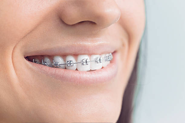 Best Veneers and Lumineers  in Ephrata, PA